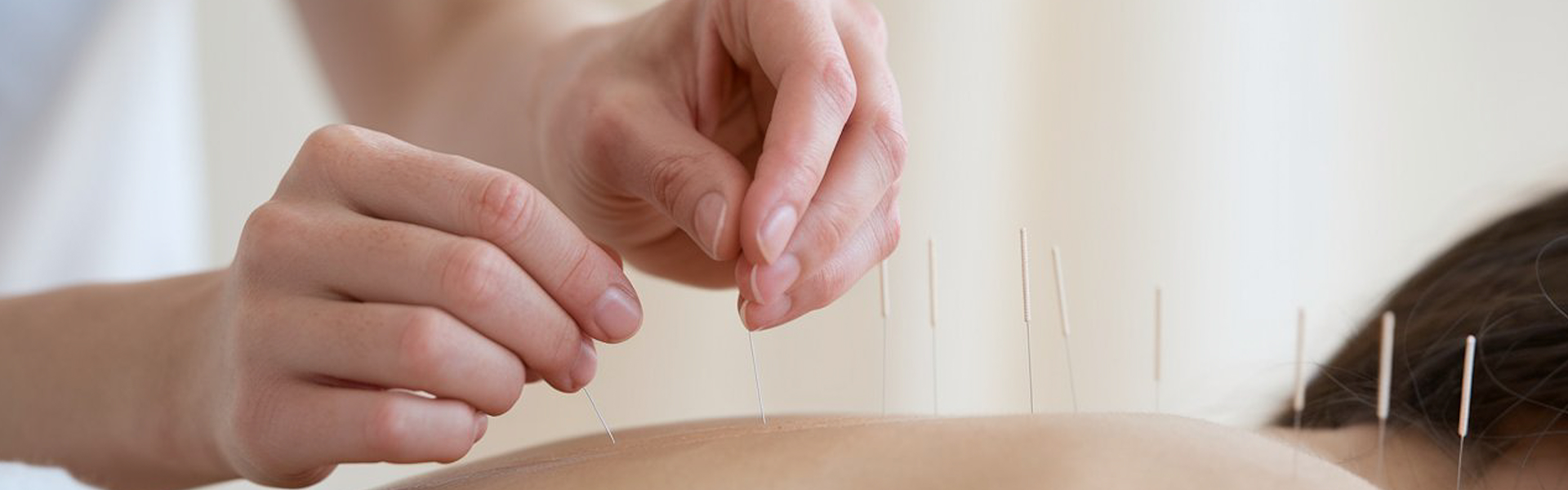 Acupuntura Sistmica e Tcnicas Complementares 