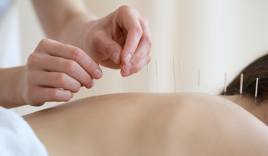 Acupuntura Sistmica e Tcnicas Complementares 